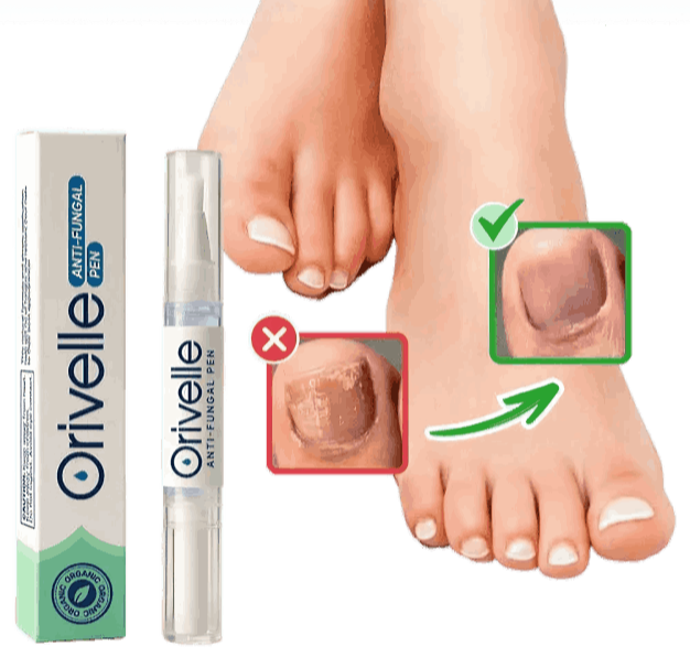 what is Orivelle Anti-Fungal Pen
